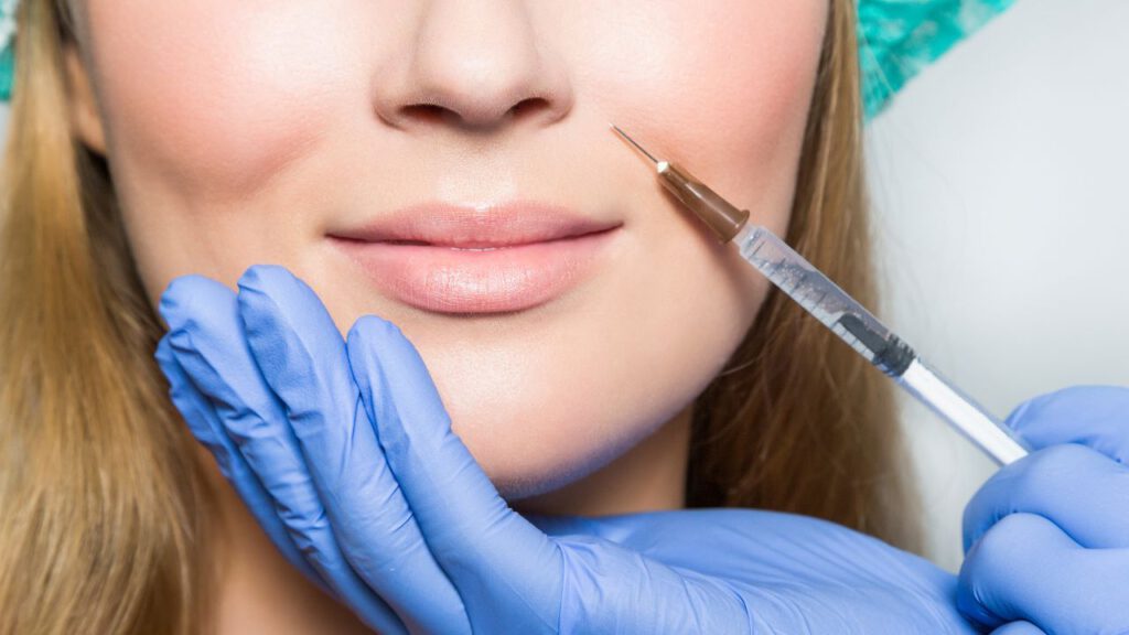 Lip Filler Simulation for Your Ideal Aesthetic Experience