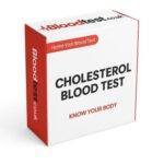 Cholesterol Blood Test Basics for Plymouth Residents